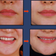 Image for article titled Joker Plastic Surgery? Permanent Duck Faces? I'm Not Sure Which!